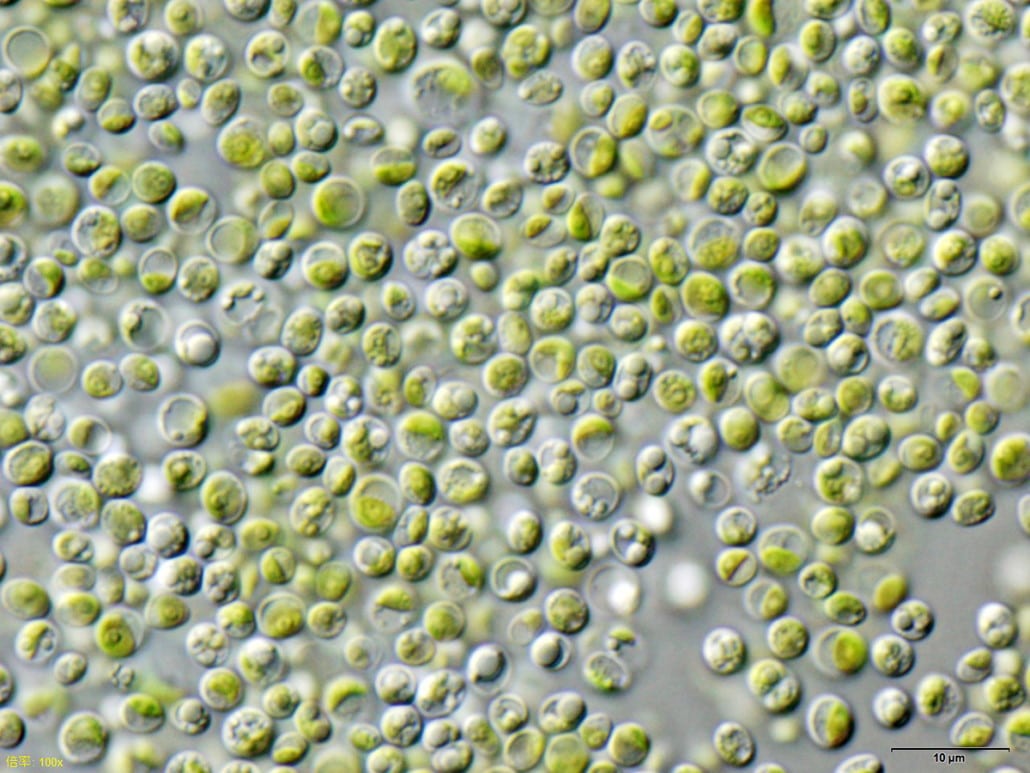 gruene-kugelalge-chlorella-vulgaris