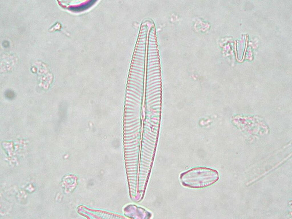 navicula-lanceolata-schiffchenfoermige-einzellige-kieselalge