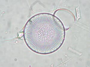 zackenscheibchen-stephanodiscus-neoastraea